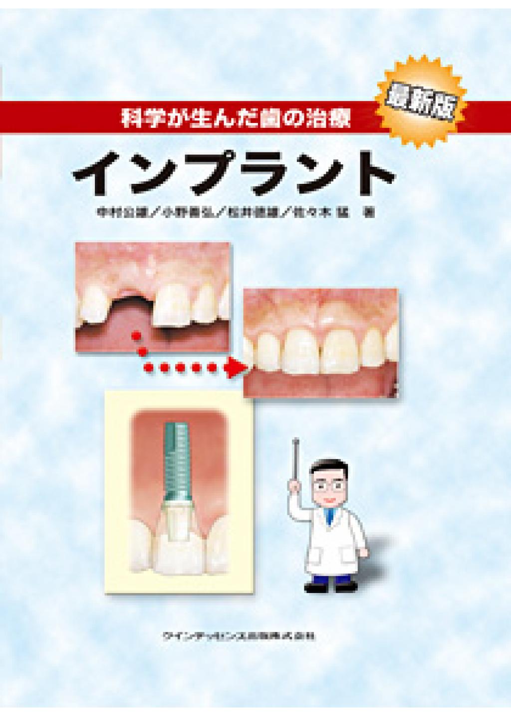 科学が生んだ歯の治療 インプラント 最新版の購入ならWHITE CROSS