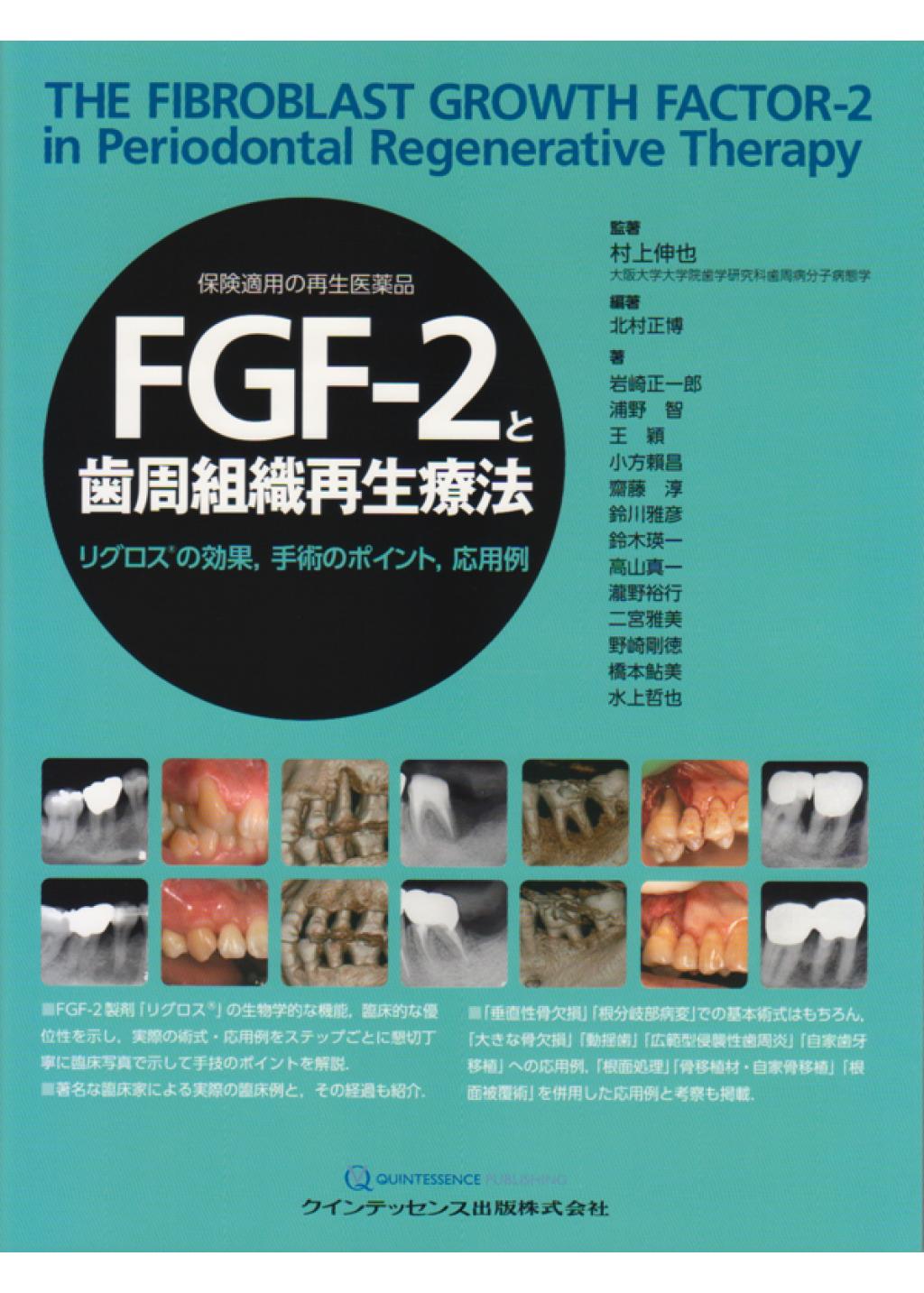FGF-2と歯周組織再生療法の購入ならWHITE　CROSS