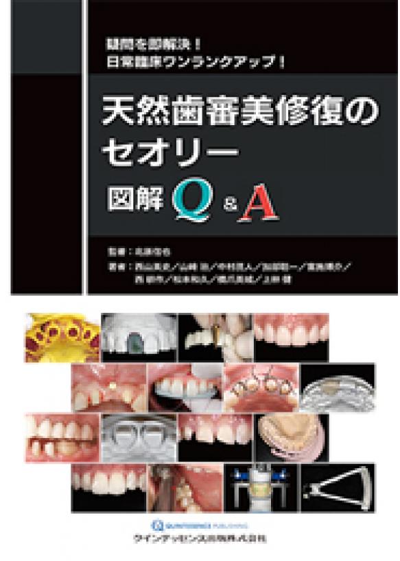 天然歯審美修復のセオリー 図解Q&amp;Aの画像です