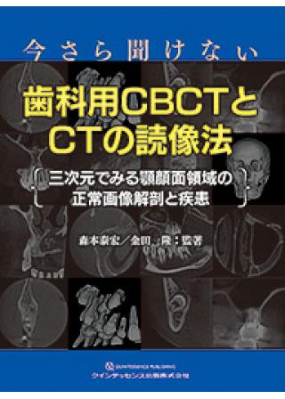 今さら聞けない歯科用CBCTとCTの読像法の画像です