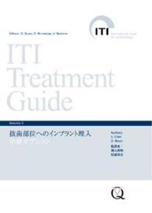 ITI Treatment Guide Volume 3　抜歯部位へのインプラント埋入の画像です