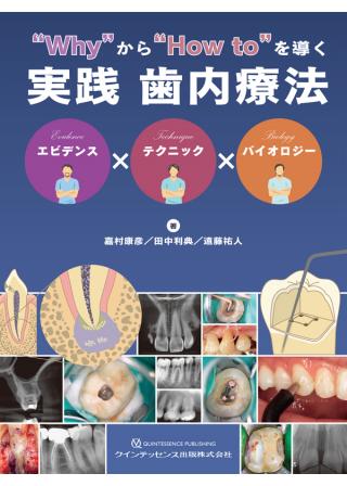 “Why”から“How to”を導く実践 歯内療法の画像です