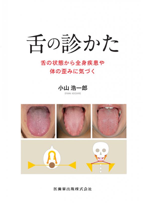 舌の診かたの画像です