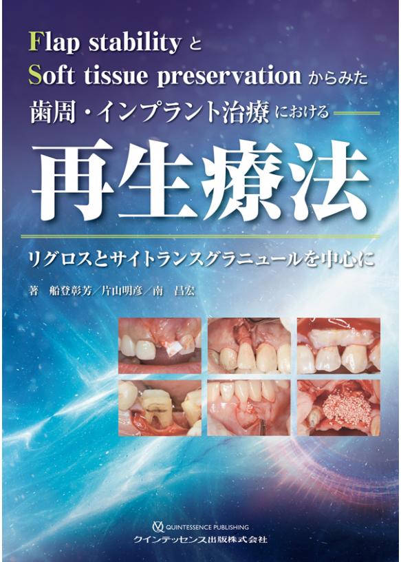 歯周・インプラント治療における再生療法の購入ならWHITE CROSS