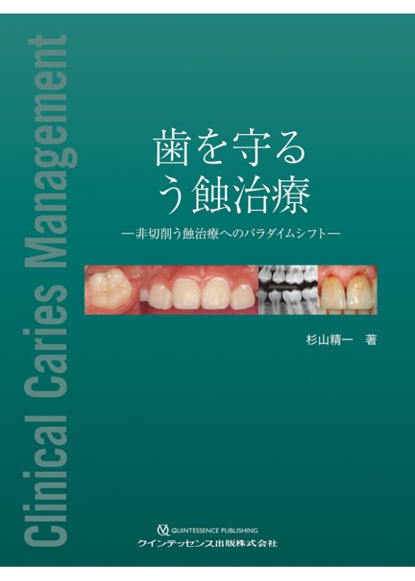 歯を守る　う蝕治療の画像です