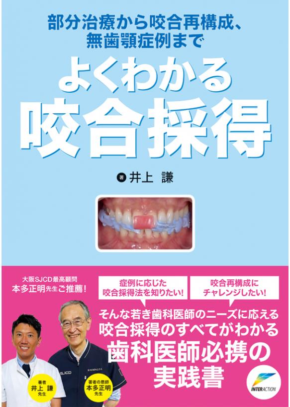 部分治療から咬合再構成、無歯顎症例まで よくわかる咬合採得の画像です