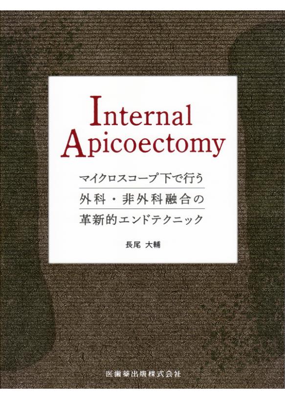 Internal Apicoectomyの画像です
