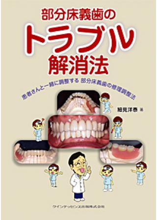 部分床義歯のトラブル解消法の画像です