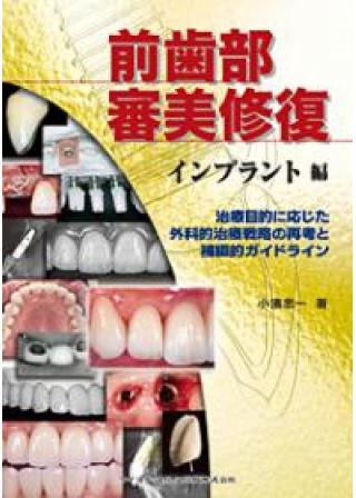 成功に導くための基準とステップがわかる前歯部審美治療のルールの購入