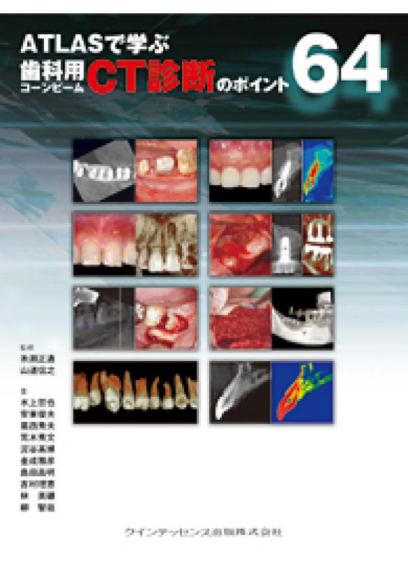 ATLASで学ぶ 歯科用コーンビームCT診断のポイント64の画像です