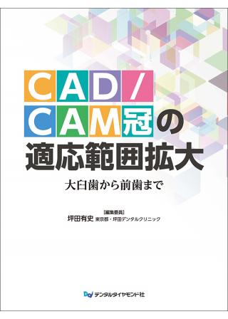 CAD/CAM冠の適応範囲拡大　の画像です