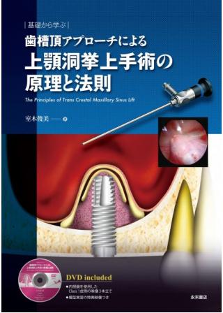 歯槽頂アプローチによる上顎洞挙上手術の原理と法則（DVD付）の画像です