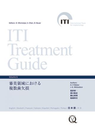 ITI Treatment Guide Volume 6　審美領域における複数歯欠損の画像です