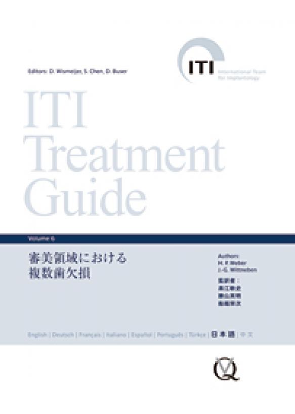 ITI Treatment Guide Volume 6　審美領域における複数歯欠損の画像です