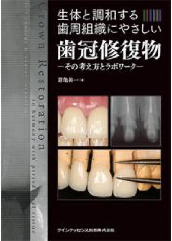 生体と調和する歯周組織にやさしい歯冠修復物の画像です