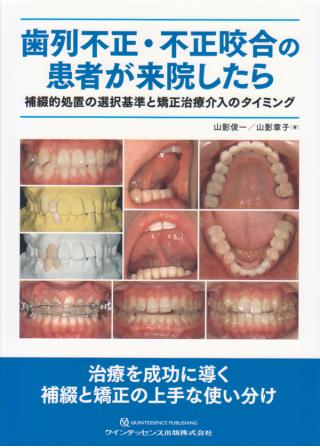 歯列不正・不正咬合の患者が来院したらの画像です