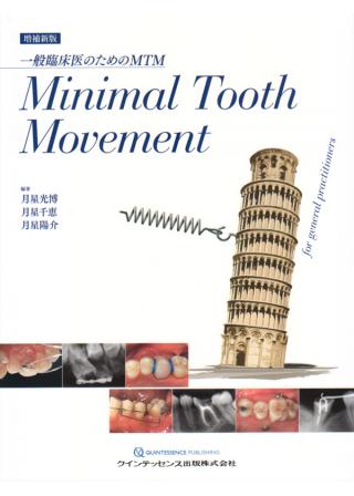 増補新版　Minimal Tooth Movementの画像です